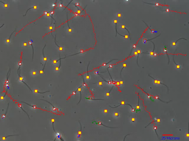 Motility Validation - Track Length Measurement